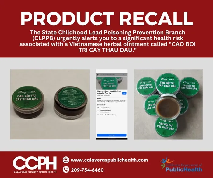 California (Hoa Kỳ): Cảnh báo nguy cơ nhiễm chì từ sản phẩm kem trị trĩ